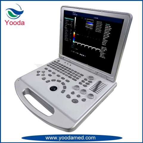 2D/3D Laptop Color Doppler Diagnosis Equipment