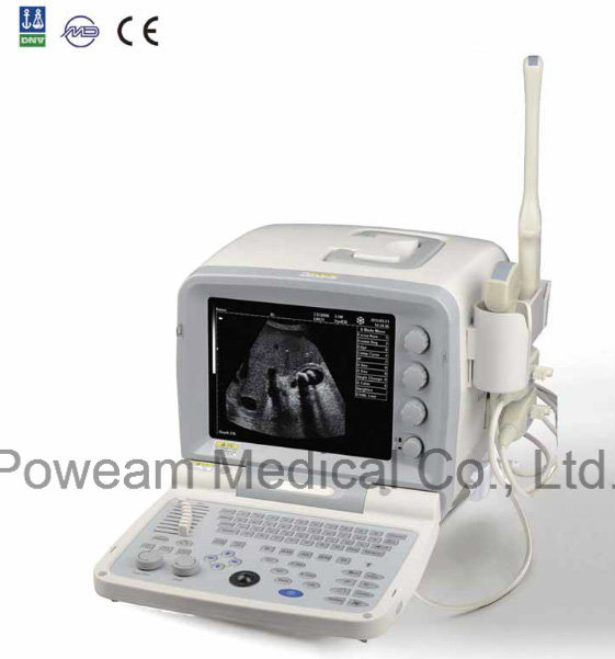 Digital Portbale Ultrasound Scanner (WHY9618F plus)