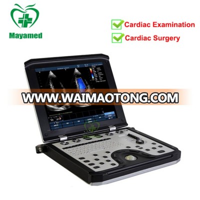 China cheapest medical equipment Heart scanner diagnostic device portable PC laptop digital cardiac B ultrasound machine