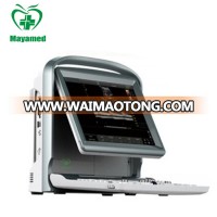 MY-A032 MAYA medical equipment 2016 hot sale portable color doppler cardiology USG ultrasound machine for sale