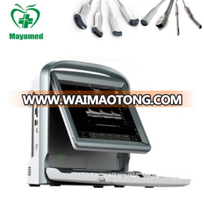 MY-A032 MAYA medical equipment Portable Color Doppler Ultrasound System