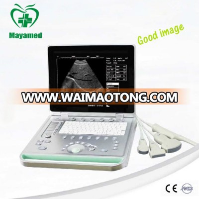 MY-A009C Full digital portable laptop ultrasound machine for pregnancy/Mobile baby ultrasound