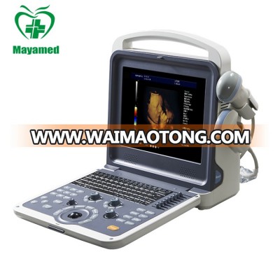 China cheapest medical portable 4d full digital color doppler b ultrasound scanner/scan/machine price for pregnancy with probe