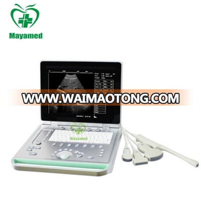 MY-A009 New hospital medical 3d transvaginal machine portable pregnancy ultrasound scanner