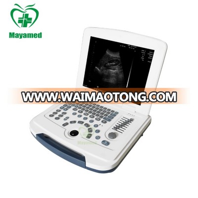 MY-A007B Full-digital Laptop Ultrasound Scanner