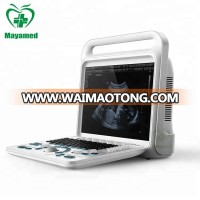 Hot Sale New MY-A027B Portable Medical Full Digital Color Doppler Ultrasound Scanner Machine Price with ISO/CE certificate