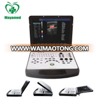 MY-A024A medical portable 3D color doppler ultrasound scanning machine pc Ultrasound scanner for sale