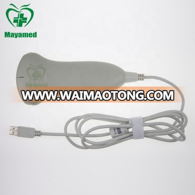 High Resolution Medical Portable Ultrasonic Diagnostic System Devices Type Smallest Ultrasound USB Convex Probe price for laptop