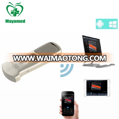 Hot SALE Medical Portable Ultrasonic USG System Pocket Wifi Wireless Changeable Head Probe type Ultrasound Scanner