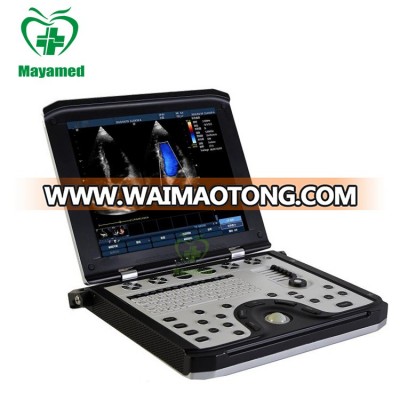 MY-A039B Medical Portable Ultrasound System 3D 4D Color Doppler Ultrasound Machine Price with Probe